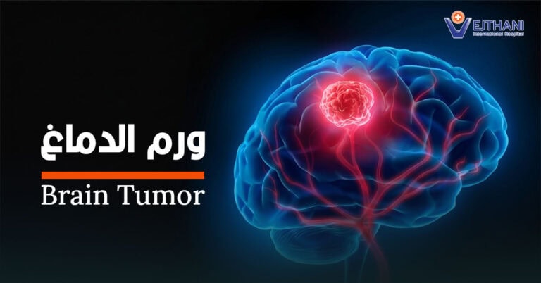 ورم الدماغ