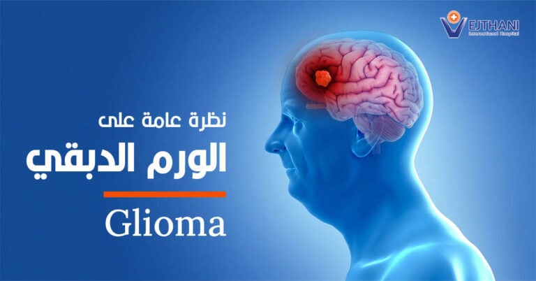 الورم الدبقي