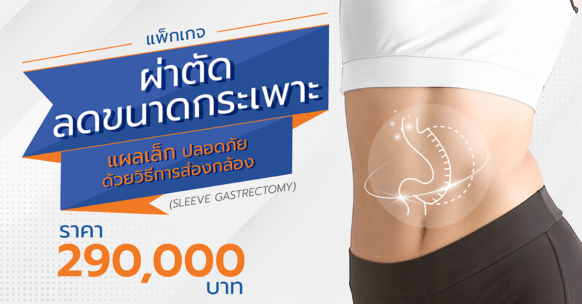 ผ่าตัดลดขนาดกระเพาะ แผลเล็ก ปลอดภัย ด้วยวิธีการส่องกล้อง