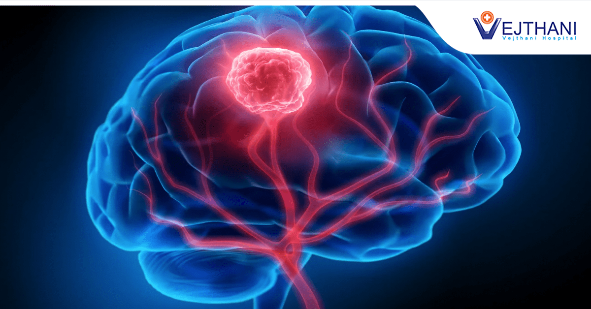 Raising Awareness: The Urgent Reality of Brain Tumors