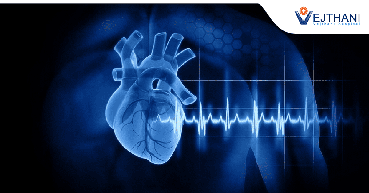 Beating Heart Bypass Surgery: Understanding Off-Pump CABG