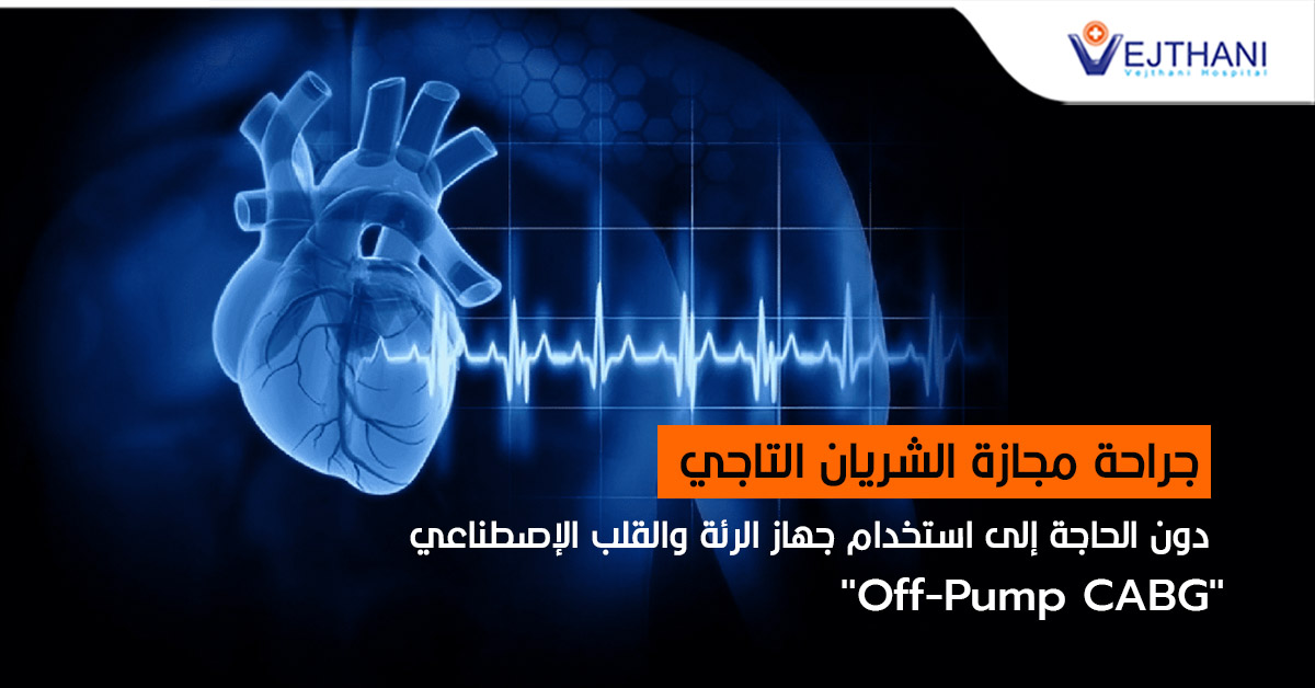 جراحة مجازة الشریان التاجي دون الحاجة إلى استخدام جھاز الرئة والقلب الإصطناعي .”Off-Pump CABG”