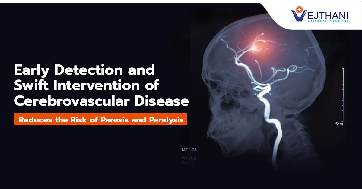 Early Detection and Swift Intervention of Cerebrovascular Disease Reduces the Risk of Paresis and Paralysis