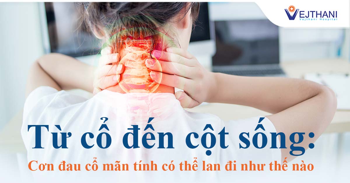 Từ cổ đến cột sống: Cơn đau cổ mãn tính có thể lan đi như thế nào