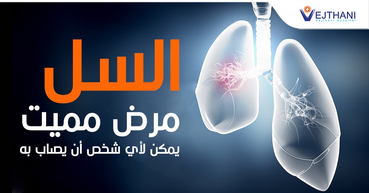 السل مرض مميت يمكن لأي شخص أن يصاب به