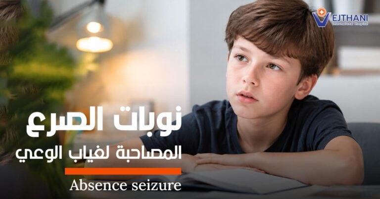 نوبات الصرع