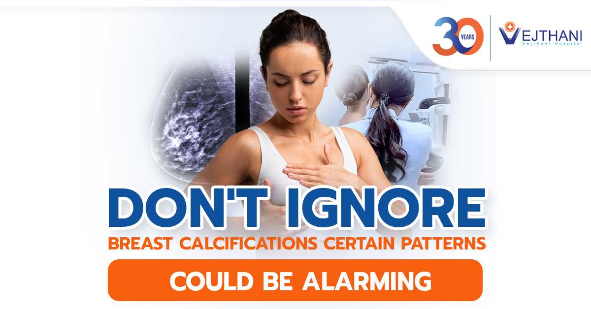 Don’t Ignore Breast Calcifications, Certain Patterns Could be Alarming