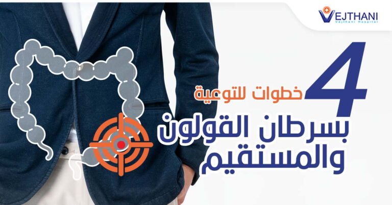4 Steps for Colorectal Cancer