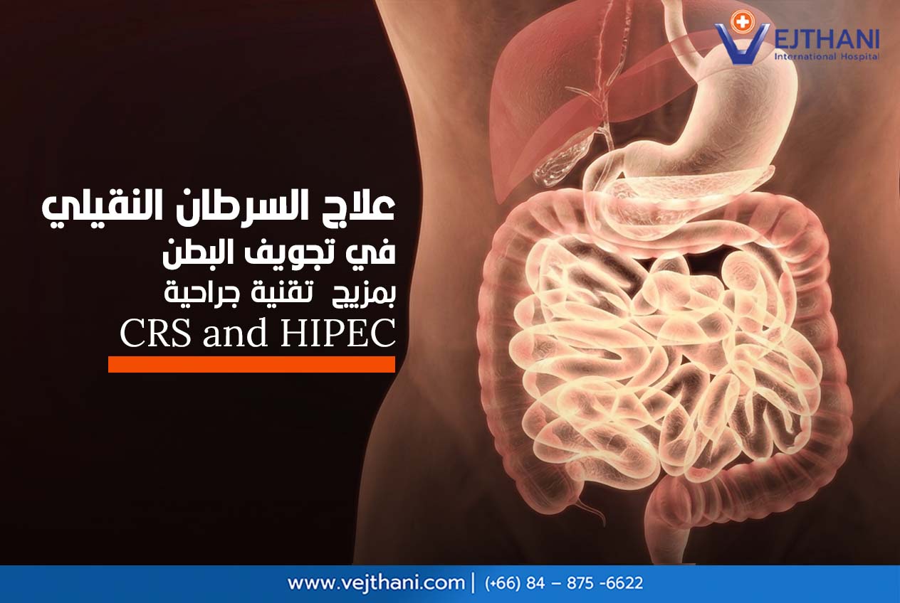 علاج السرطان النقيلي 