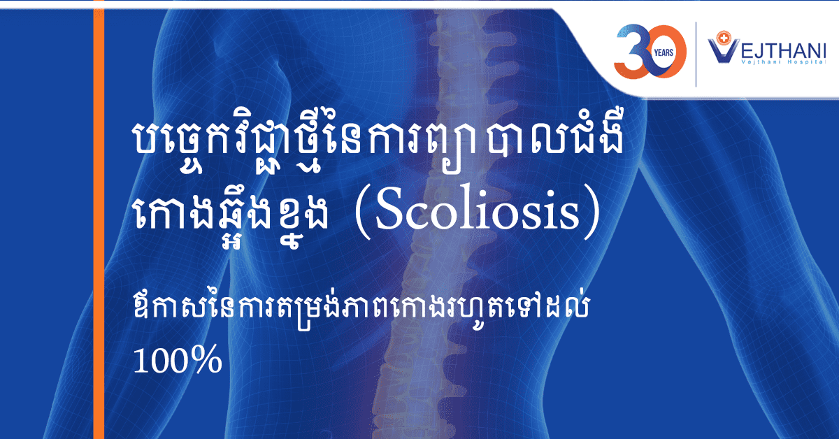 បច្ចេកវិទ្យាកម្រិតខ្ពស់នៃការព្យាបាលជំងឺកោងឆ្អឹងខ្នង Scoliosis