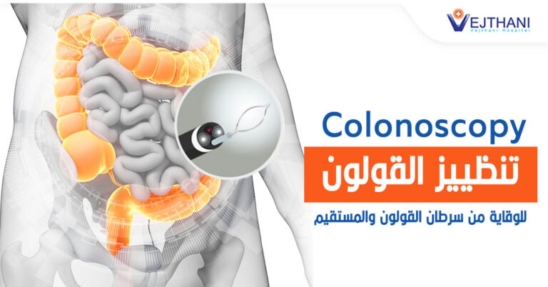 Colorectal Cancer Can be prevented by Colonoscopy