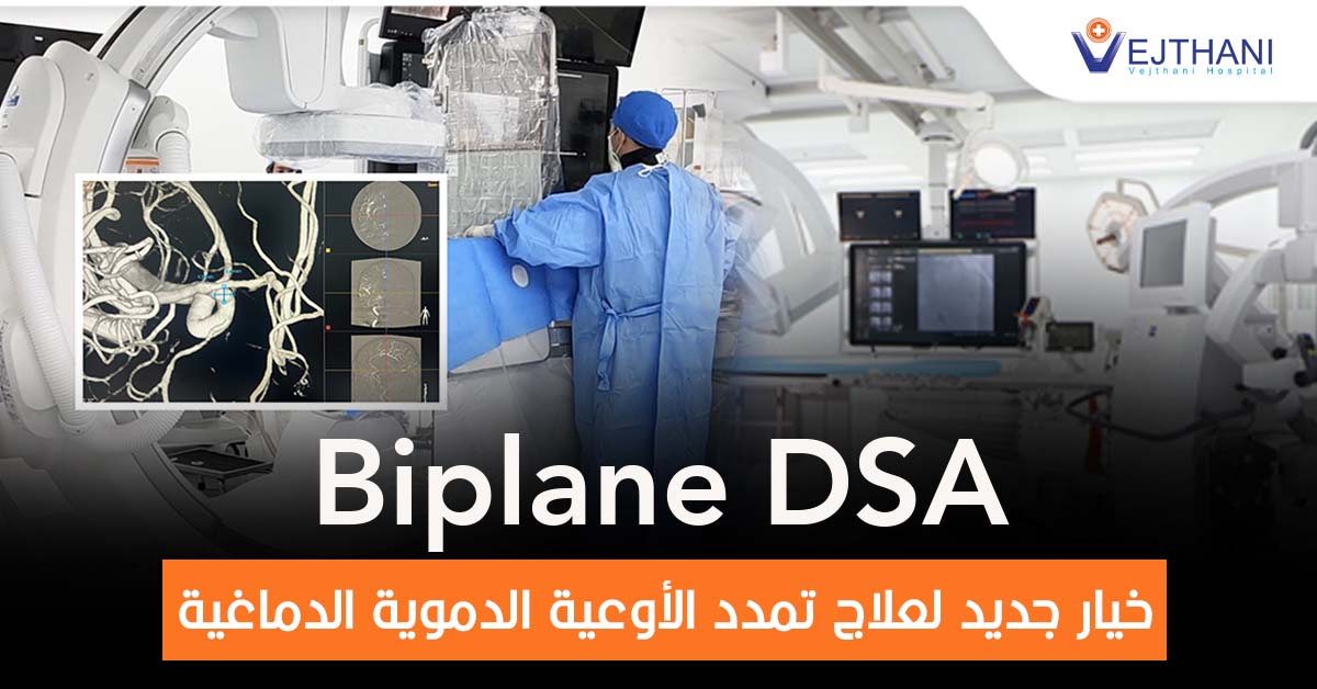 Biplane DSA : خيار جديد لعلاج تمدد الأوعية الدموية الدماغية.