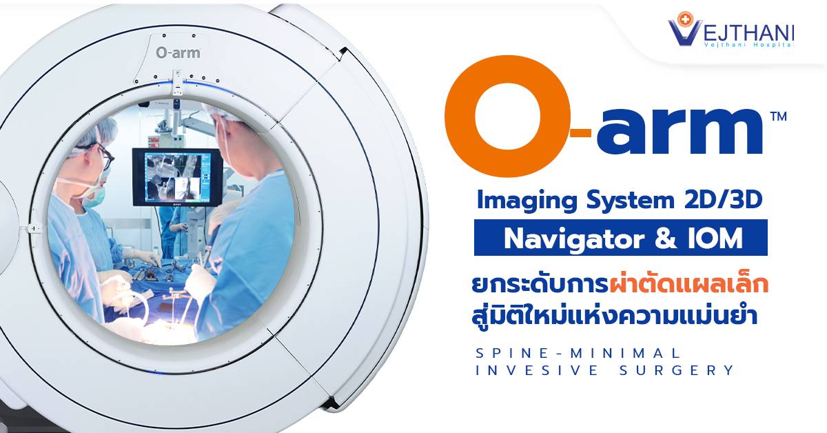 เทคโนโลยีเอกซเรย์ 3 มิติ O-Arm 3D Navigation