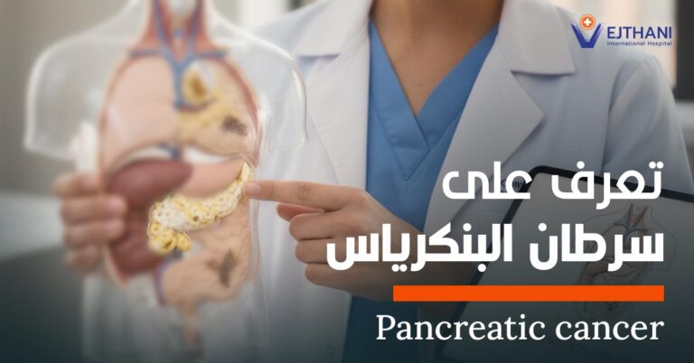 سرطان البنكرياس