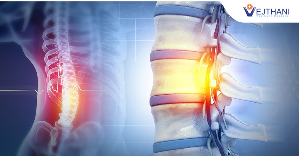 Complex Spine Surgical Treatment
