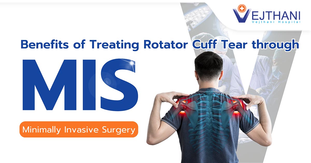 Benefits of Treating Rotator Cuff Tear through Endoscopic Minimally