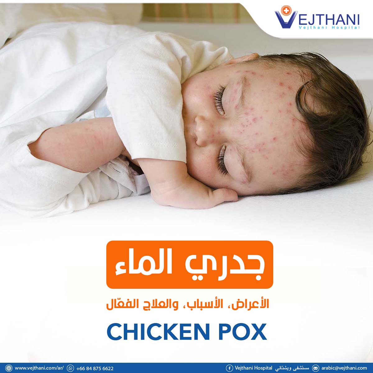 جدري الماء: الأعراض، الأسباب، والعلاج الفعّال