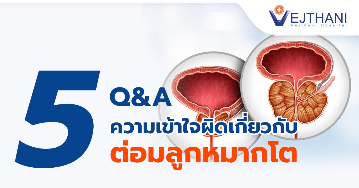 5 ความเข้าใจผิดเกี่ยวกับต่อมลูกหมากโตที่คุณอาจไม่เคยรู้