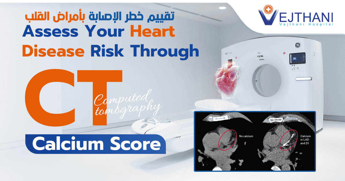 إبتكار جد دٌ لاستبدال القلب بالقسطرة ) TAVI ( بدون جراحة