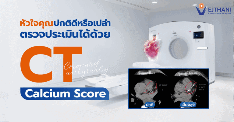 การตรวจหาแคลเซียมหลอดเลือดหัวใจ