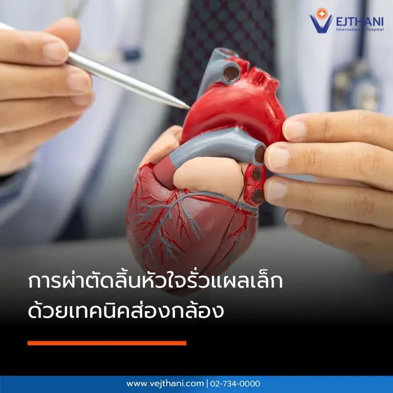 การผ่าตัดลิ้นหัวใจรั่ว แผลเล็ก ด้วยเทคนิคส่องกล้อง