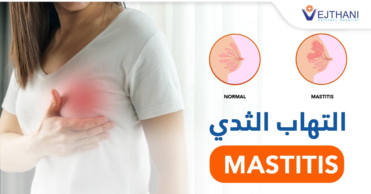التهاب الثدي: الأسباب والأعراض وطرق العلاج الفعالة