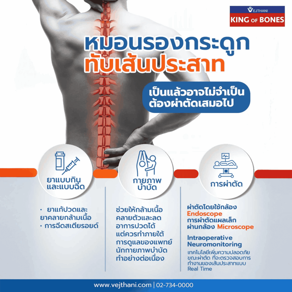 หมอนรองกระดูกทับเส้นประสาท