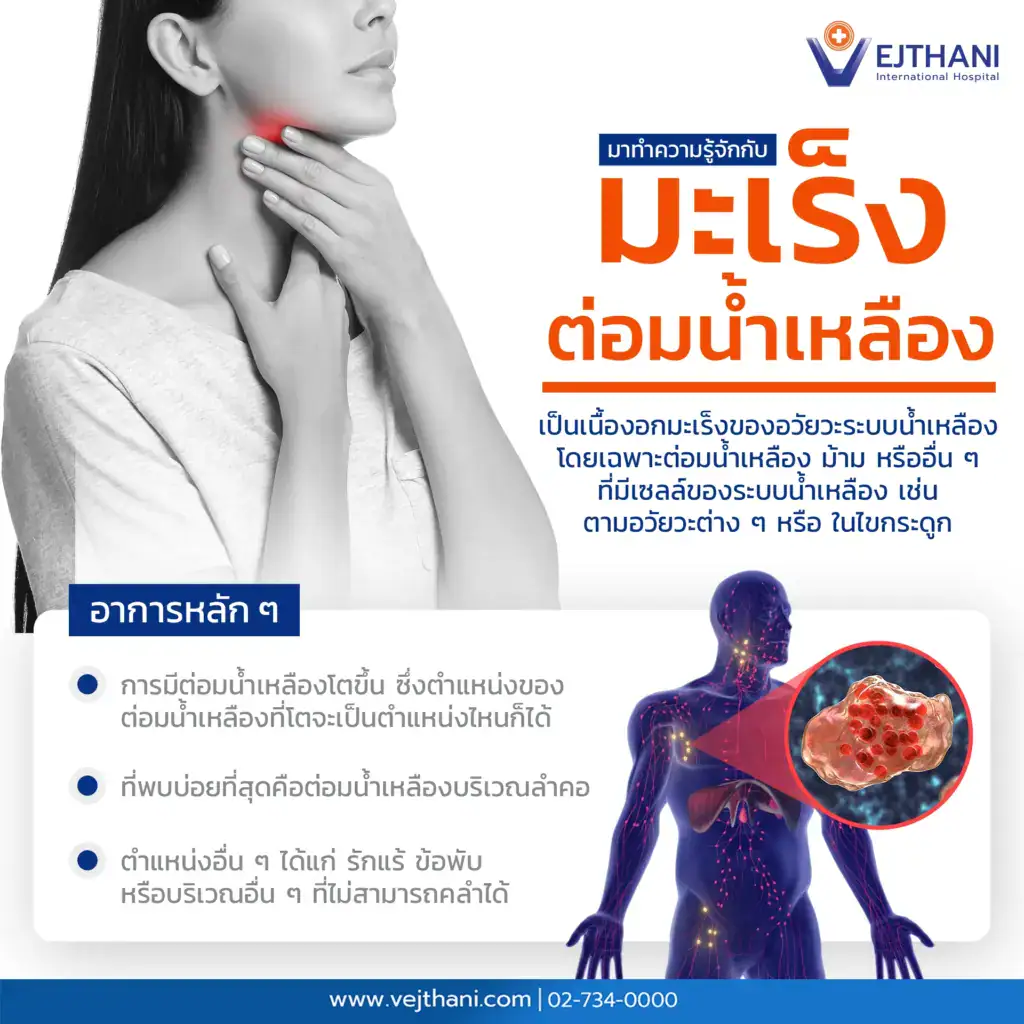 มะเร็งต่อมน้ำเหลืองคืออะไร