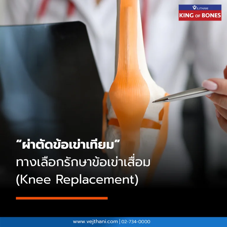 การผ่าตัดข้อเข่าเทียม ฟื้นตัวไว