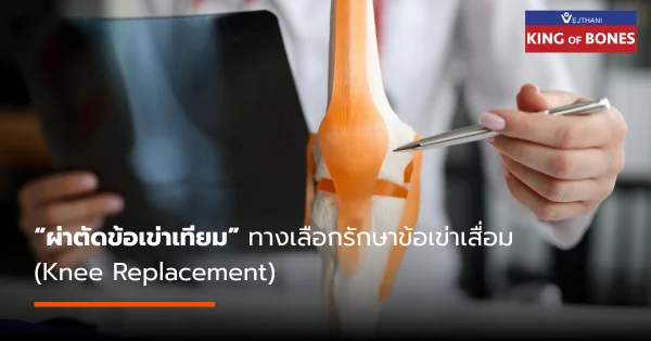 การผ่าตัดข้อเข่าเทียม ฟื้นตัวไว