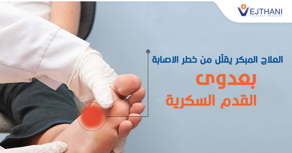 العلاج المبكر يقلّل من خطر الاصابة بعدوى القدم السكرية