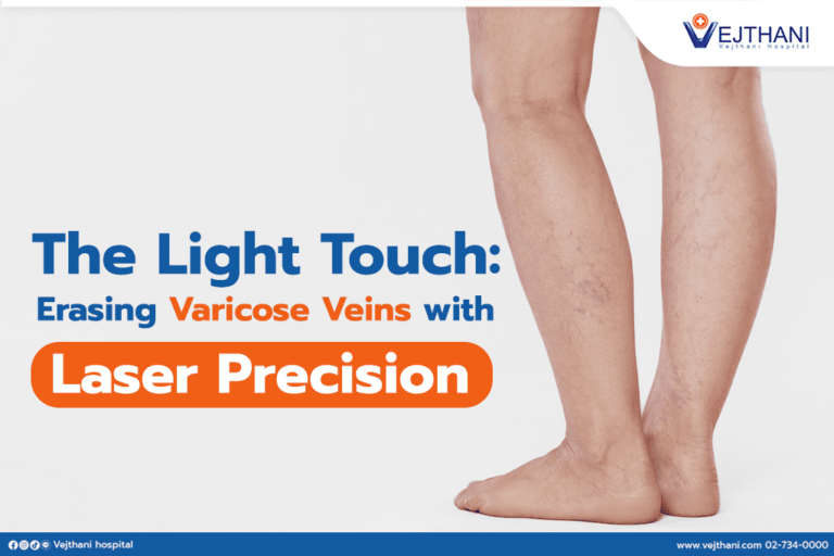 The Light Touch: Erasing Varicose Veins with Laser Precision - Vejthani