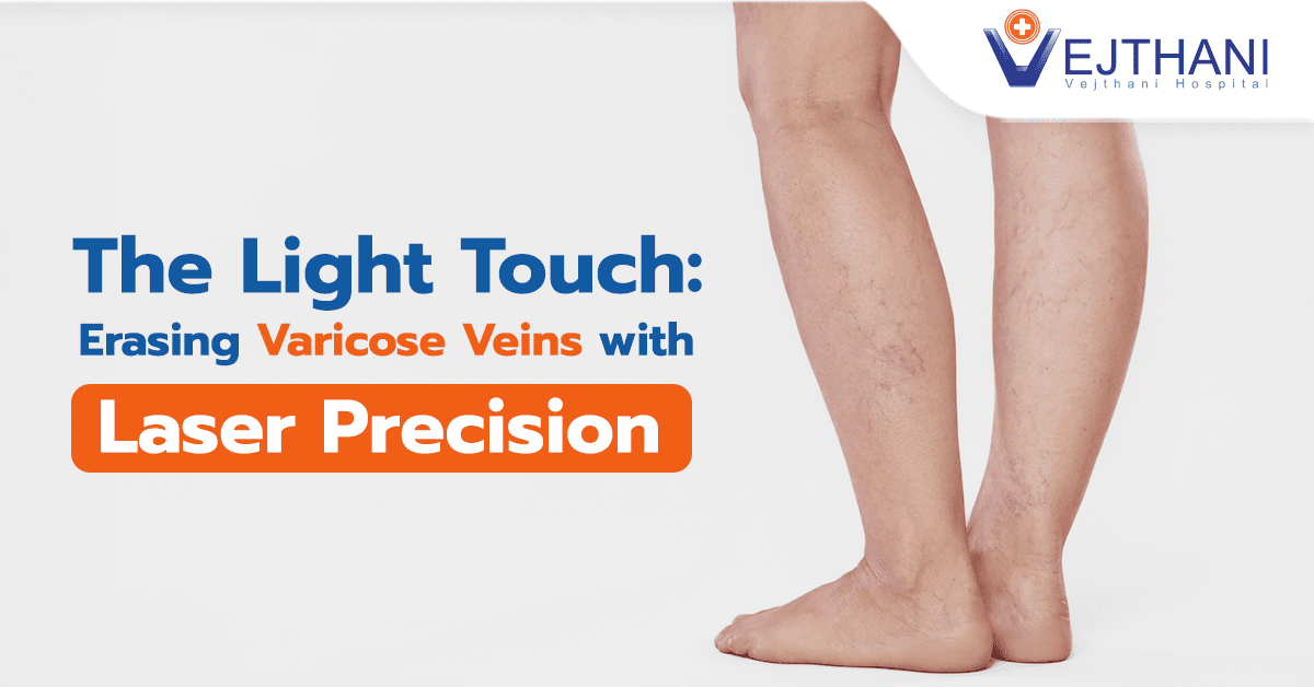 The Light Touch: Erasing Varicose Veins with Laser Precision