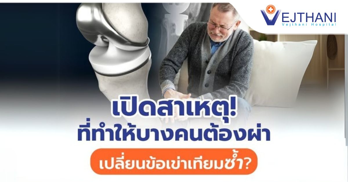 5 สาเหตุ ที่ทำให้ต้องผ่าตัดแก้ไขข้อเข่าเทียม