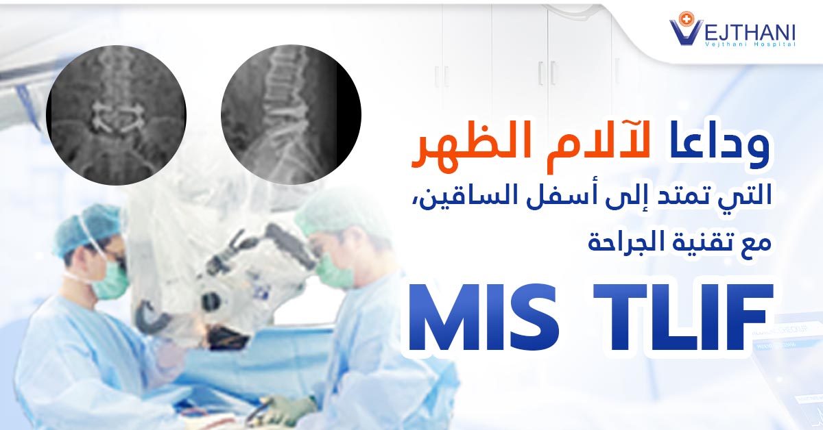 قل وداعًا لآلام الظهر التي تمتد إلى ساقيك، مع تقنية MIS TLIF الجراحية