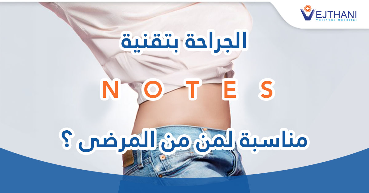 الجراحة بتقنية “NOTES” مناسبة لمن من المرضى؟