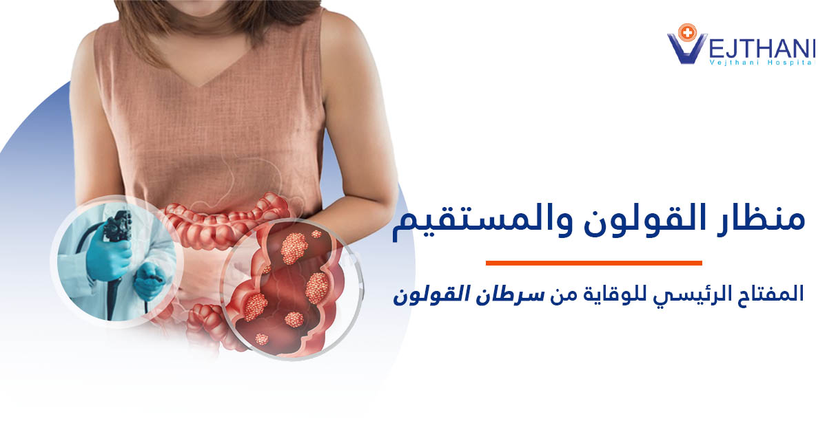 منظار القولون والمستقيم: المفتاح الرئيسي للوقاية من سرطان القولون