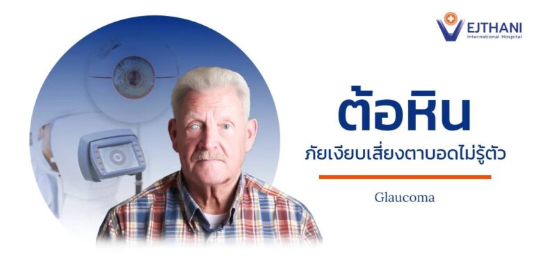 ต้อหินภัยเงียบ
