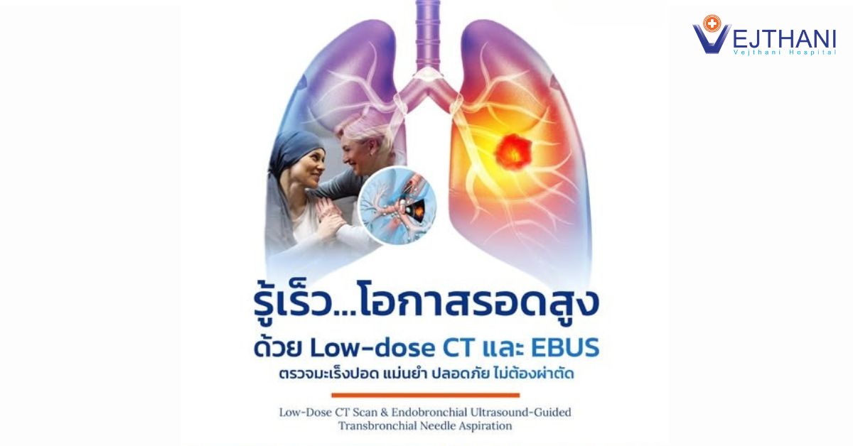 รู้เร็ว โอกาสรอดสูง ด้วยเทคโนโลยี Low – dose CT และ EBUS