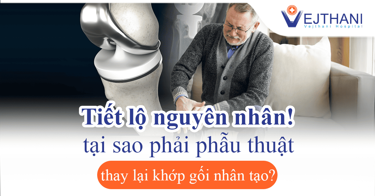 5 Nguyên nhân cần thay lại khớp gối nhân tạo