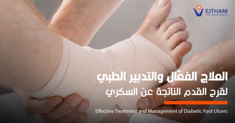 علاج قرح القدم السكرية