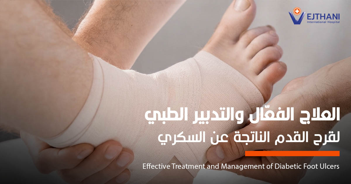 العلاج الفعّال والتدبير الطبي لقرح القدم الناتجة عن السكري
