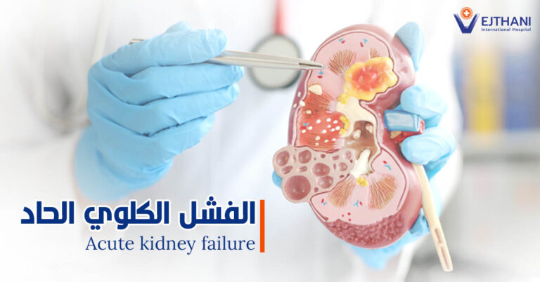 Acute kidney failure