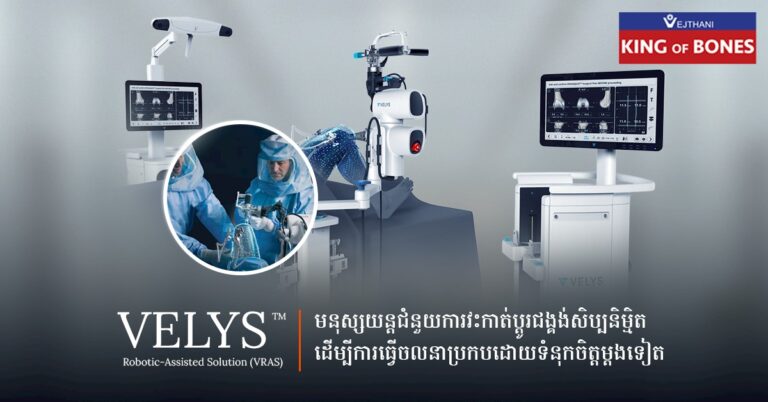 មនុស្សយន្តជំនួយការវះកាត់ប្តូរជង្គង់សិប្បនិម្មិត Veley