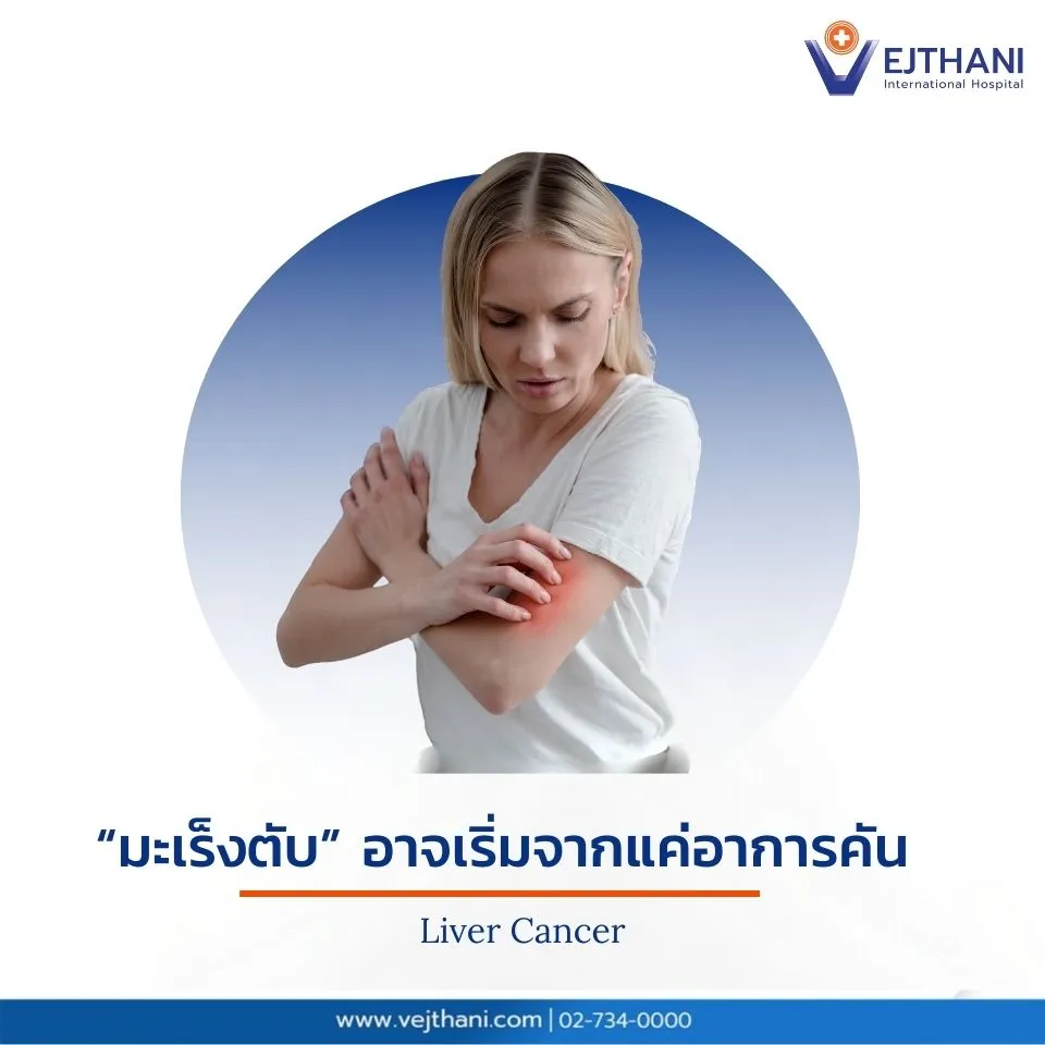 ผู้หญิงเกาแขนด้วยความกังวลถึงความเสี่ยงของโรคมะเร็งตับที่อาจมาจากอาการง่าย