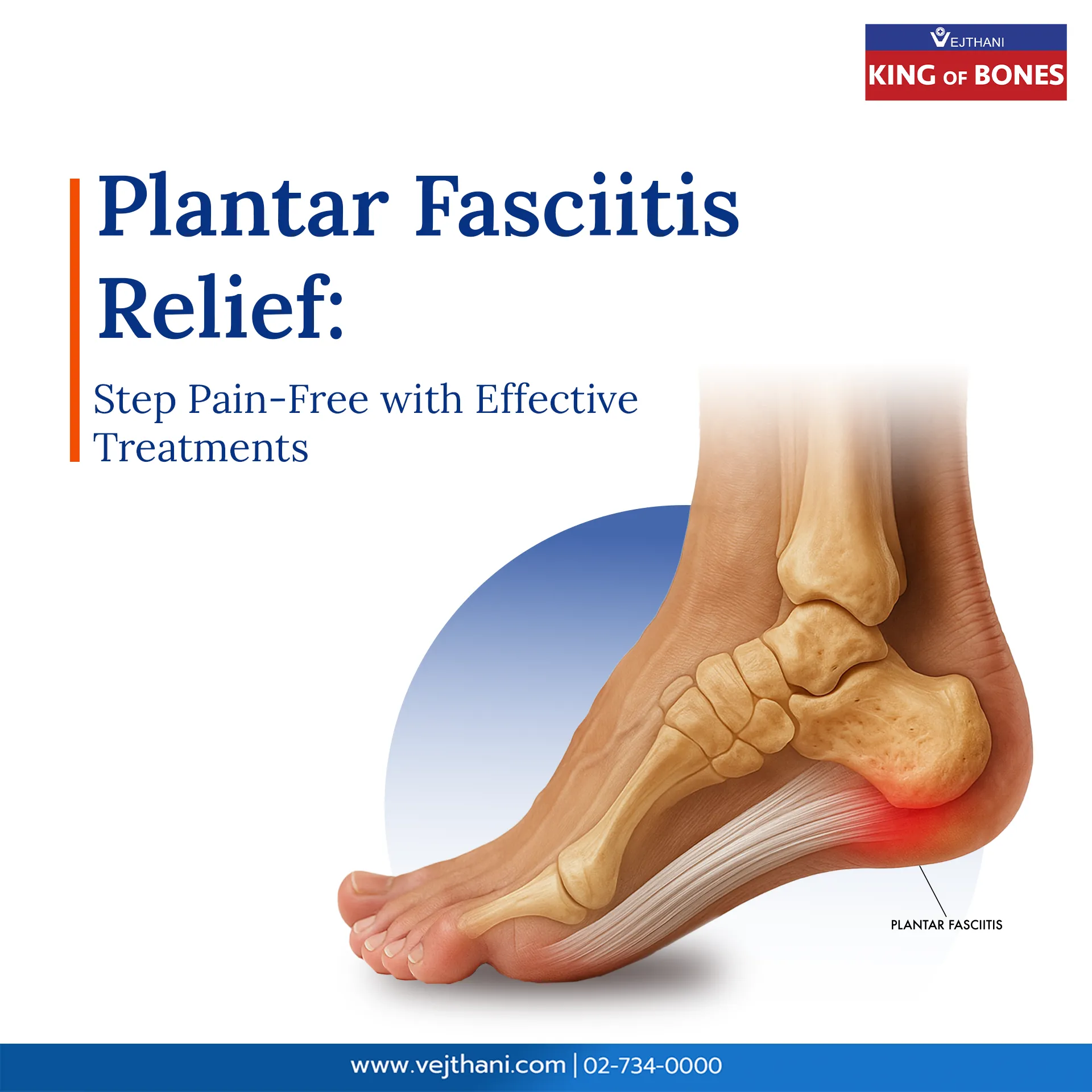 Medical illustration of foot showing plantar fascia inflammation at the heel, highlighting plantar fasciitis pain and treatment options at Vejthani International Hospital