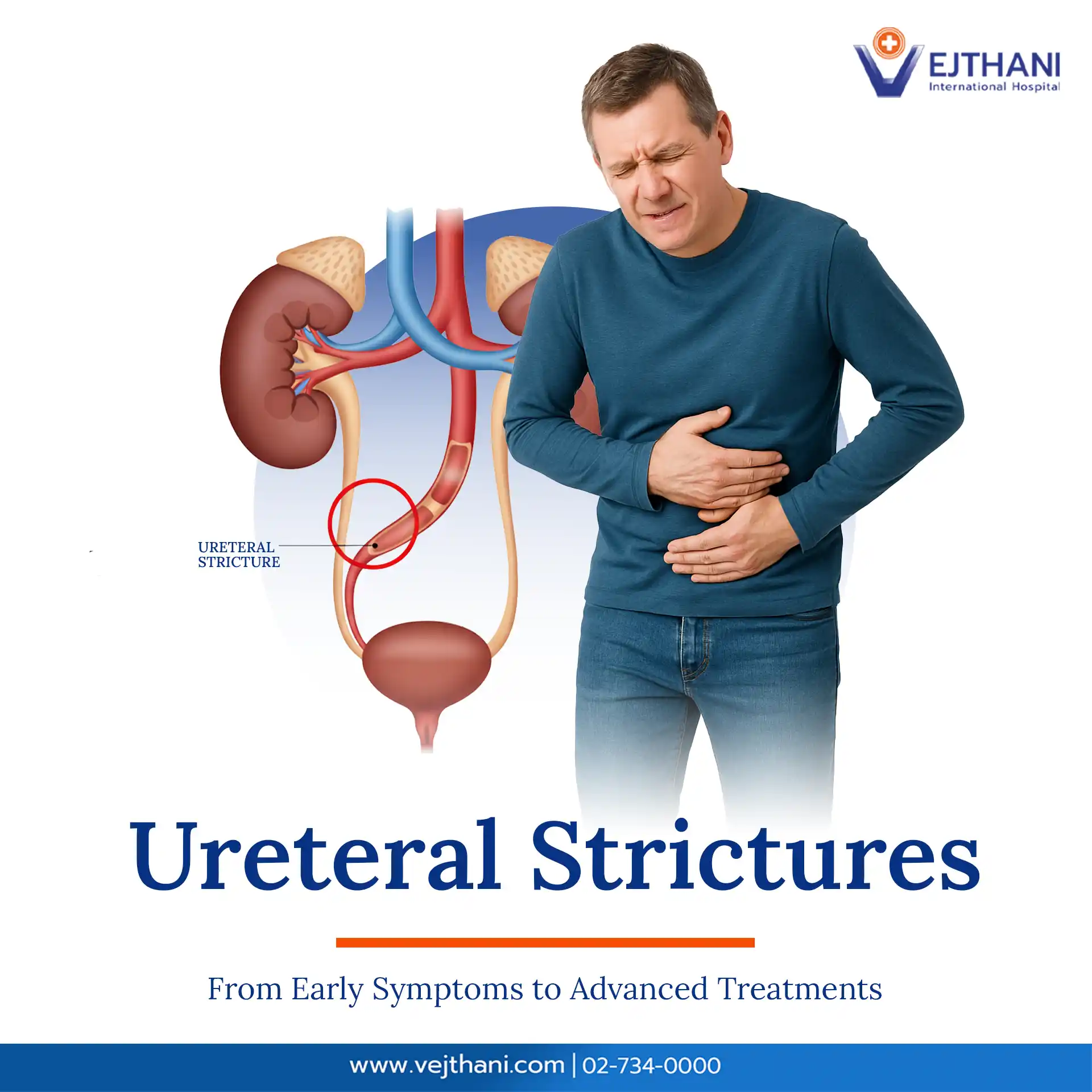 Man holding his abdomen in pain with medical illustration of the urinary system highlighting ureteral stricture, representing symptoms, causes, and treatments at Vejthani International Hospital