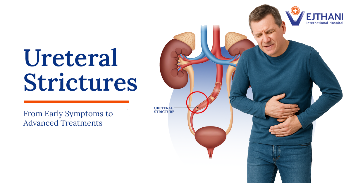 Ureteral Strictures: From Early Symptoms to Advanced Treatments