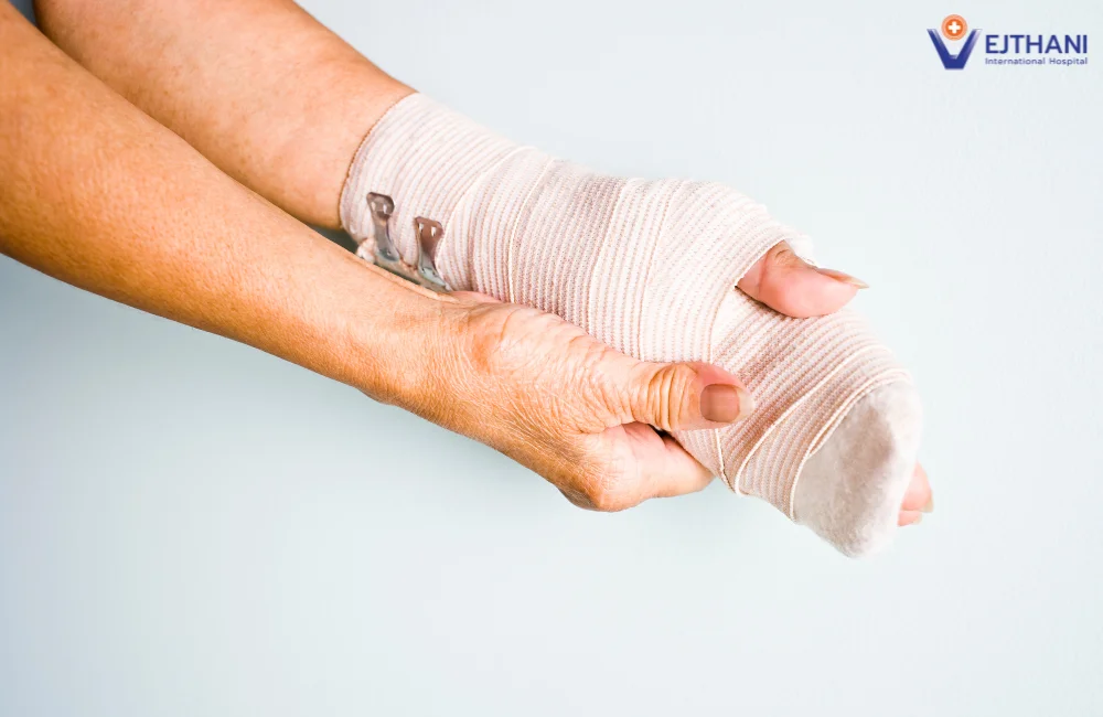  How to Treat Hand Injuries