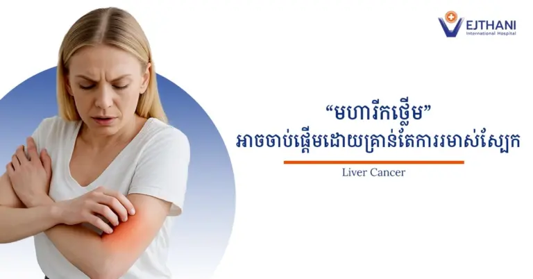 រមាស់រាងកាយប្រសិនបើវានៅតែបន្តដោយគ្មានមូលហេតុច្បាស់លាស់ ហើយមានអមជាមួយរោគសញ្ញាផ្សេងទៀតដូចជា អស់កម្លាំង ជម្ងឺខាន់លឿង ណែនពោះ ឬបាត់បង់ចំណង់អាហារ អ្នកគួរតែទៅជួបគ្រូពេទ្យភ្លាមៗ ដើម្បីពិនិត្យថ្លើមឱ្យបានហ្មត់ចត់។